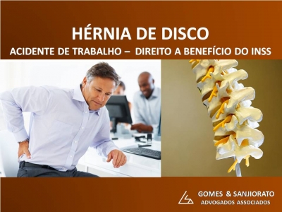 ACIDENTE DE TRABALHO (H&Eacute;RNIA DE DISCO)