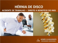 ACIDENTE DE TRABALHO (H&Eacute;RNIA DE DISCO)