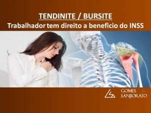 ACIDENTE DE TRABALHO